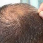 hair