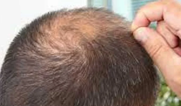 hair