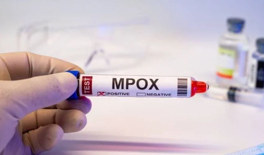 mpox